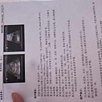 怀孕35周了，去照彩超，说小孩左右心房大小偏差大，你们有检查跟我一样的吗？好担心，