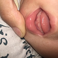 路过宝妈帮忙看看是不是要长牙了，最近夜醒频繁，很烦躁