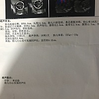 姐妹们帮忙看一下 男孩女孩