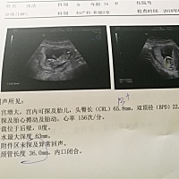 为啥我的b超字这么少？