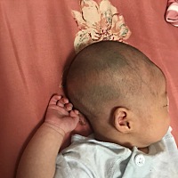 今天给宝宝理完发才发现，这头怎么一块一块的青这正常吗？