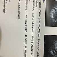 双卵巢多囊样改变姐妹们帮忙看看严重吗下面是检查结果j