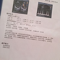 有能看懂这个报告单的吗？医生说是先天性心脏病，说得让人好担心