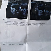 有没有宝妈跟我一样怀孕六周多无明显胎心胎芽的？