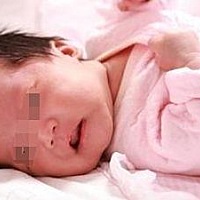 胆红素300umol/l(17.5mg/dl)入脑几率？ 黄疸值的表示单位有两种，mg/dl和umol/l。换算公式是：1mg/dl=17...