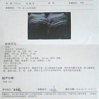 孕妈们帮忙看看能看出是男宝女宝吗？