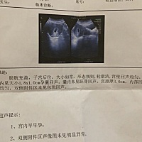 孕囊是长的话，男孩的几率有多大？