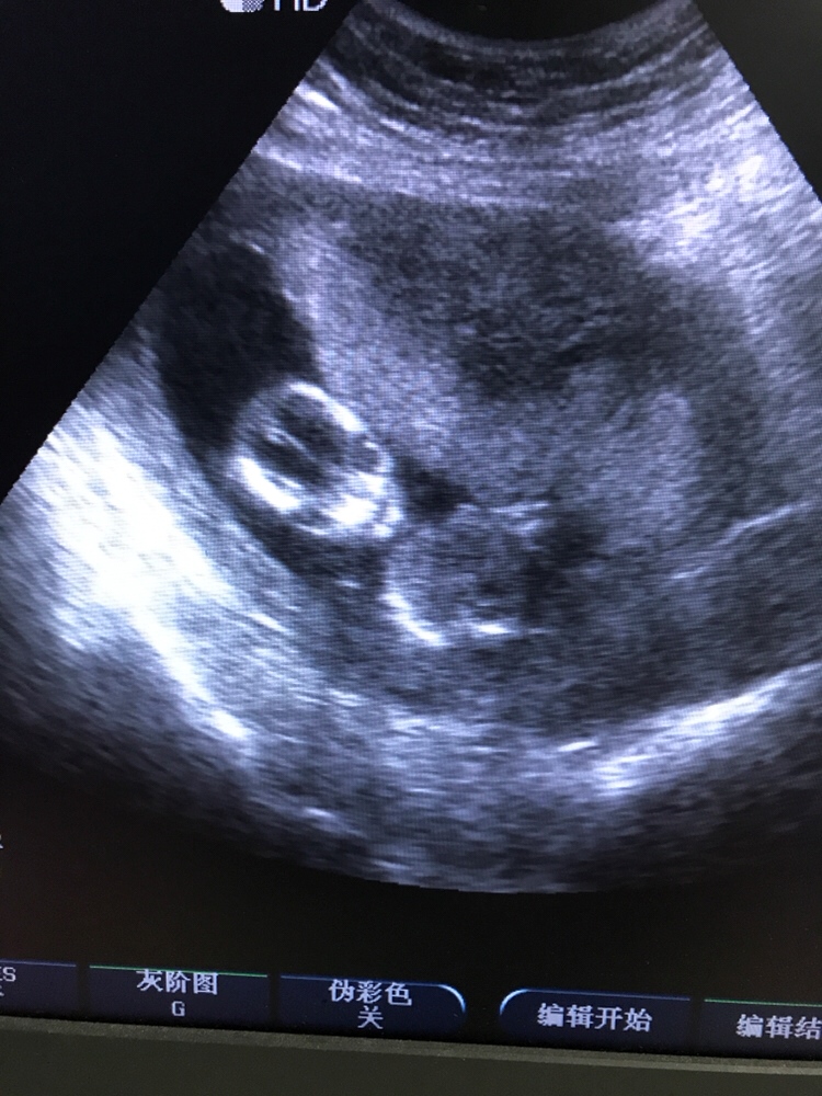 工作中偶然切到的神切面，供大家一乐～