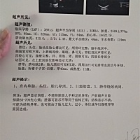 有看的懂B超单子宝妈医生吗？看看是不是正常的医生说出来脐带绕颈两周一切正常