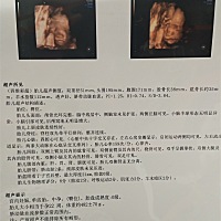 刚通过的四维，大家帮看看是男孩还是女孩