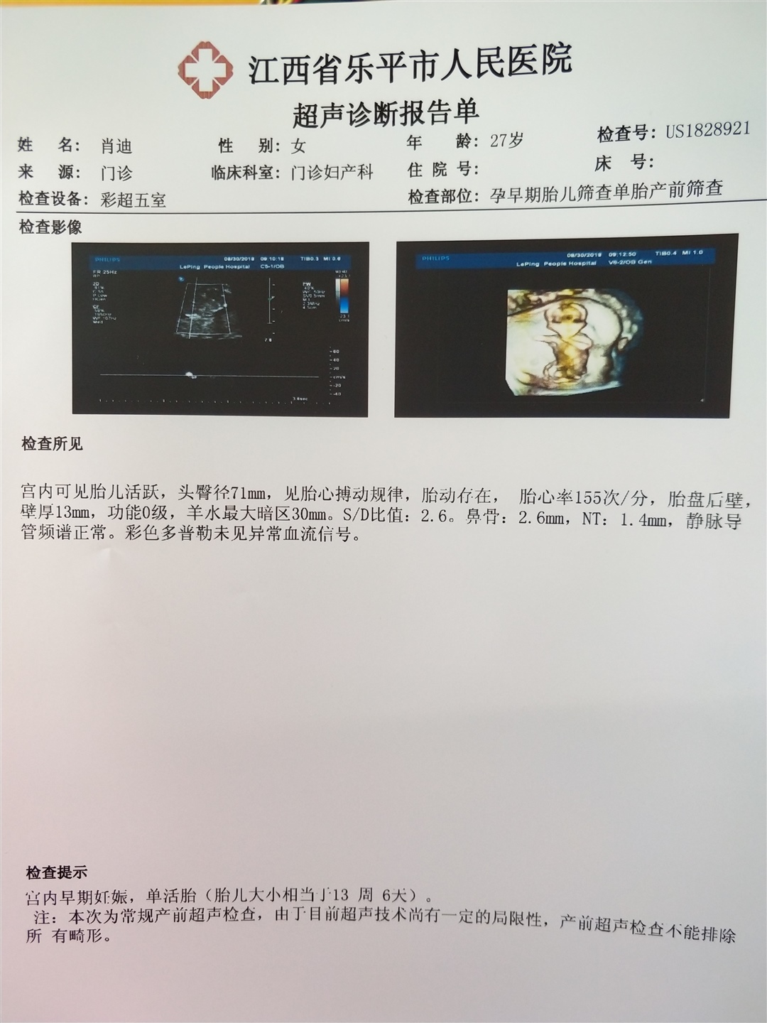 这能看出男 女吗？希望会看的帮忙看看