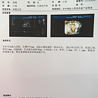 这能看出男 女吗？希望会看的帮忙看看