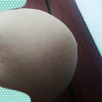 33周了，昨晚肚子还白白的(除了中间一条黑线)今早肚子就好痒，长了妊娠纹，以为自己这么晚了不会长了�...