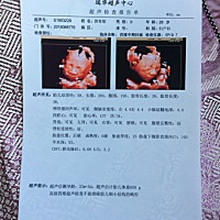 非常好奇男孩还是女孩？看别人家的单子都写的好多，我的写的好简单，感觉这医院一定不好收费还贵