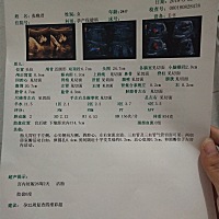 今天做四维彩超，宝宝特别调皮，好像再跟你躲猫猫似的，医生说总是拍不到脸蛋儿！  好在最后一次性...