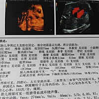 看男女，娱乐娱乐