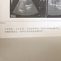 在线等。今天做了个B超显示是这样。 这是怀孕了吗？
