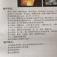这个可以看出男宝还是女宝吗？出于好奇，今天去糖耐了结果偏高了，好担心！有什么办法可以降下来？