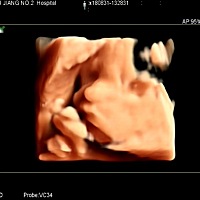 今天做四维，好模糊都看不清楚宝宝的脸，不不知道像爸爸还是像麻麻，也不知道是男宝宝还是女宝宝，为什...