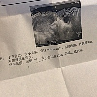 都说排卵试纸不准确，特意做了个卵泡监测，就这一两天，加油💪