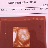 大家帮忙看看像男宝宝还是女宝宝，纯属好奇！