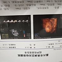 男孩还是女孩呢？大家帮忙看看呗23周＋1天