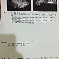 大家好！今天做的排卵测试，能看懂的麻烦回复下谢谢🙏