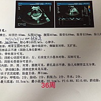 区别方法1：从孕妇的肚子的形状来判断。孕妇的肚型尖凸，会怀男孩；肚型浑圆，则怀女孩。 区别方法2：看...