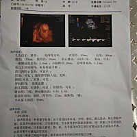 女娃吗？