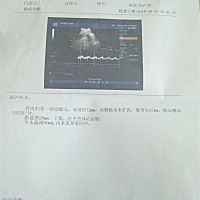 谁会看，能看出宝宝多重么，求告知