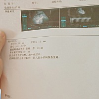 亲们帮帮我看看是男宝还是女宝