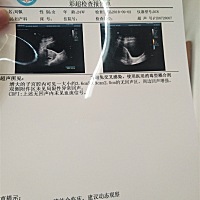 孕囊都已经很大了连卵黄囊都没有，胎心胎芽也没有，医生说可能是空囊，怎么办，怎么办，要个小孩子就这...