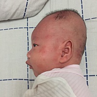 有经验的宝妈帮我看看这是湿疹吗？热就变成红斑，凉了又消下去变成颗粒，用什么药膏好？宝宝刚满月