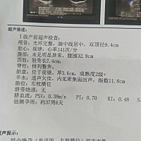 这两张B超单，一张是8月25号照的，一张是今天照的，怎么8月25号照的宝宝还要大点，是医院检查的不准，有...