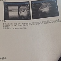 八周的腹超单，有懂的大神帮我预测下男女呗