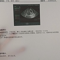 下面b超照可以看出男宝女宝吗？
