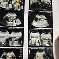 有谁懂得，想知道到底是男宝还是女宝