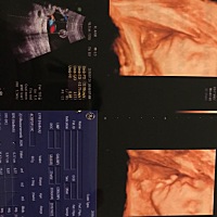 你是小棉袄还是调皮蛋😂