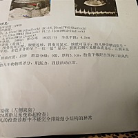 心塞，今天去医院b超检查单脐动脉，这个陌生的词汇让我心里忐忑，圈里有单脐动脉的宝妈没，分享一下经验吧