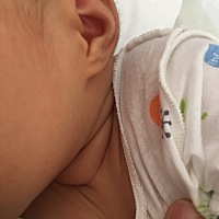 谁家宝宝像我家一样脖子下边一圈圈的肉，宝宝并不胖，只有脖子下的肉多，三四圈…不会有事吧？