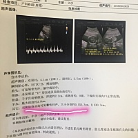 有没有准妈妈遇到这种情况啊？后来怎么样了！都焦虑坏了。