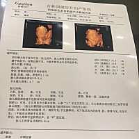 朋友的四维 我猜是男孩  各位宝妈们看呢 是男孩女孩