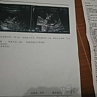 做nt检查需要抽8管血吗？？？？