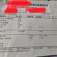 这项检查能看出胎儿好不好吗？