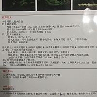 请问这个多普勒超声检查能看看出来是男是女吗？