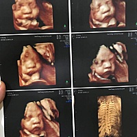 能看出是男宝还是女宝吗？只是想知道性别好买衣服而已。