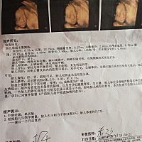 羊水4.08cm太少吗？补不上羊水是不是要刨宫产？好奇是男宝还是女宝呢？😘😘😘现在27周5天，刚做了...