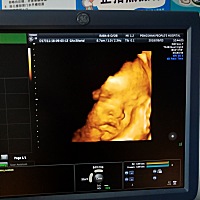 😂我老婆发的孕妇圈，结果都说宝宝像我！我觉得和她一模一样啊！