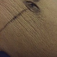 这肚子上的褶皱是不是不会恢复了。