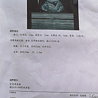 有懂得帮看下是男是女吗，单子上比我怀孕的周期大了一个星期～！谢谢好心人了先